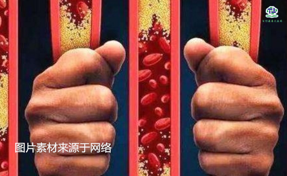 不想給血管“添堵”，盡量少吃以下這些東西，或許能讓腦梗離遠(yuǎn)些  